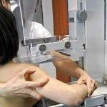 5.000 extremeñas citadas por el SES se harán una mamografía en diciembre