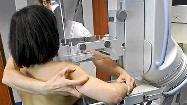 El SES hará mamografías a más de 8000 mujeres extremeñas en el mes de mayo