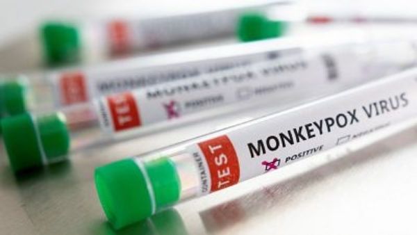 Descartada la infección por Monkeypox o viruela de los simios en Extremadura