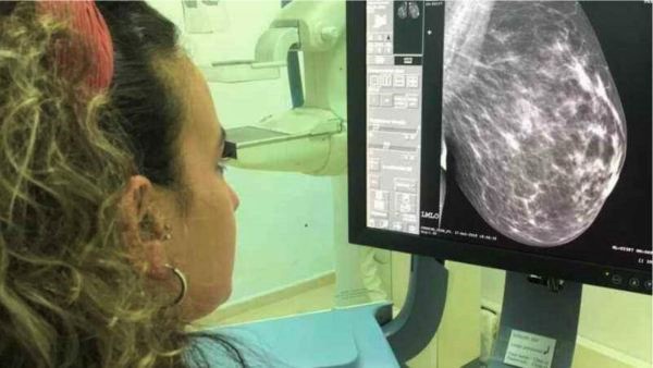 El Programa de Detección Precoz del Cáncer de Mama hará en mayo casi 8000 mamografías